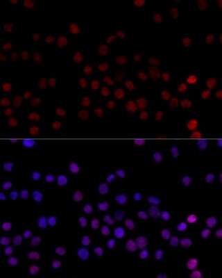 Immunocytochemistry/ Immunofluorescence: hnRNP L Antibody - BSA Free [NBP3-03640]