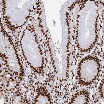 Immunohistochemistry-Paraffin: hnRNP L Antibody [NBP2-33627]