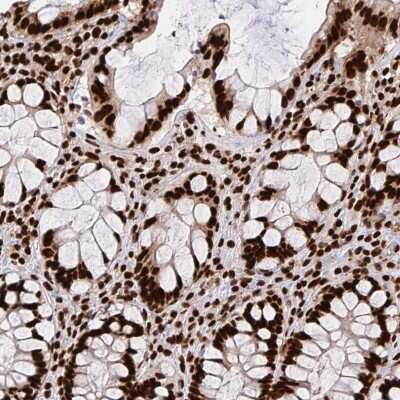 Immunohistochemistry-Paraffin: hnRNP L Antibody [NBP2-38675]