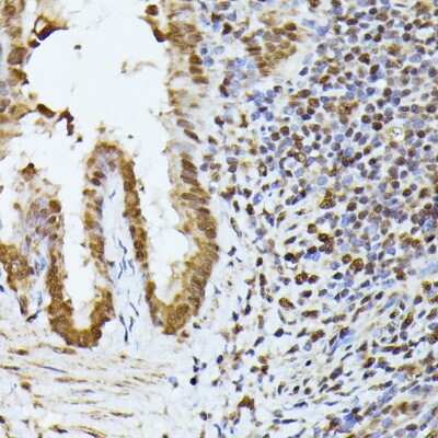 Immunohistochemistry-Paraffin: hnRNP L Antibody - BSA Free [NBP3-03640]