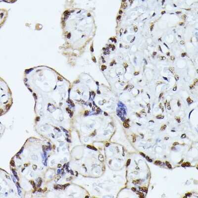 Immunohistochemistry-Paraffin: hnRNP L Antibody - BSA Free [NBP3-03640]