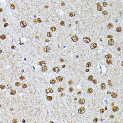 Immunohistochemistry-Paraffin: hnRNP L Antibody - BSA Free [NBP3-03640]