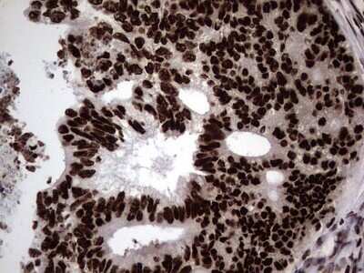 Immunohistochemistry: hnRNP L Antibody (OTI2E4) - Azide and BSA Free [NBP2-70908]