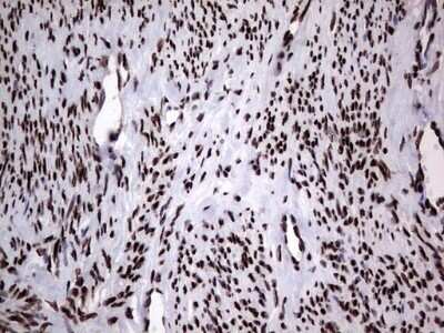 Immunohistochemistry: hnRNP L Antibody (OTI2E4) - Azide and BSA Free [NBP2-70908]