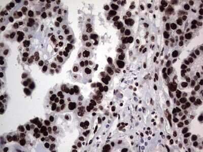 Immunohistochemistry: hnRNP L Antibody (OTI2E4) - Azide and BSA Free [NBP2-70908]
