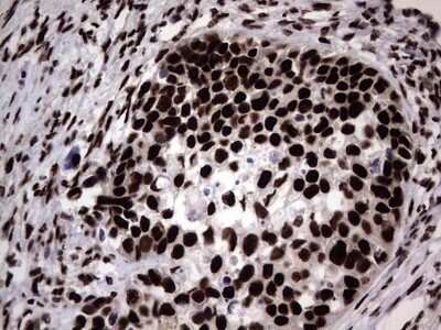 Immunohistochemistry: hnRNP L Antibody (OTI2E4) - Azide and BSA Free [NBP2-70908]