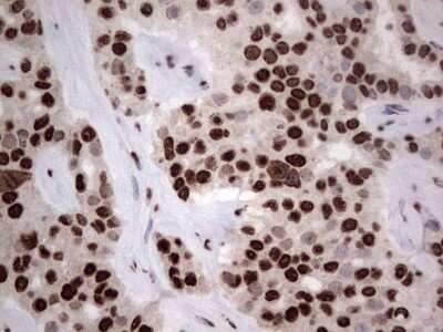Immunohistochemistry: hnRNP L Antibody (OTI2E4) - Azide and BSA Free [NBP2-70908]