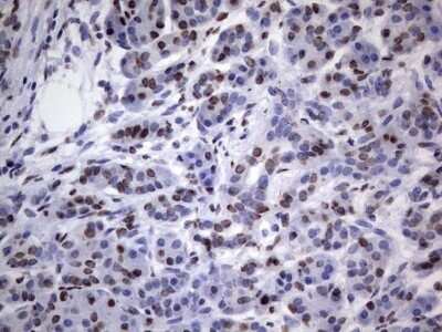 Immunohistochemistry: hnRNP L Antibody (OTI2E4) - Azide and BSA Free [NBP2-70908]