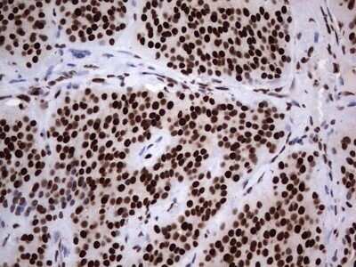 Immunohistochemistry: hnRNP L Antibody (OTI2E4) - Azide and BSA Free [NBP2-70908]