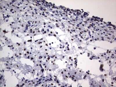 Immunohistochemistry: hnRNP L Antibody (OTI2E4) - Azide and BSA Free [NBP2-70908]