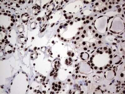 Immunohistochemistry: hnRNP L Antibody (OTI2E4) - Azide and BSA Free [NBP2-70908]