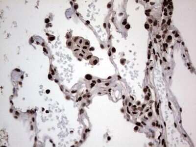 Immunohistochemistry: hnRNP L Antibody (OTI2E4) - Azide and BSA Free [NBP2-70908]