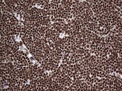 Immunohistochemistry: hnRNP L Antibody (OTI2E4) - Azide and BSA Free [NBP2-70908]