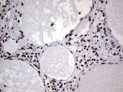 Immunohistochemistry: hnRNP L Antibody (OTI2E4) - Azide and BSA Free [NBP2-70908]