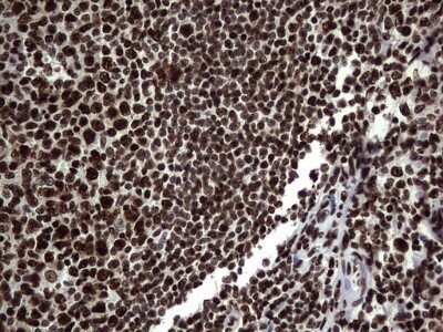 Immunohistochemistry: hnRNP L Antibody (OTI2E4) - Azide and BSA Free [NBP2-70908]