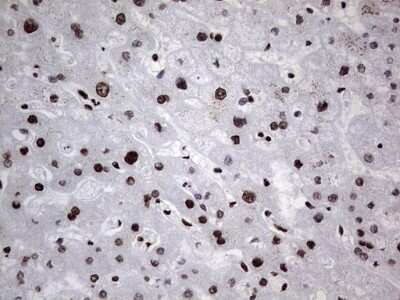 Immunohistochemistry: hnRNP L Antibody (OTI2E4) [NBP2-45990]