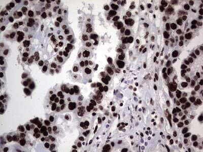 Immunohistochemistry: hnRNP L Antibody (OTI2E4) [NBP2-45990]