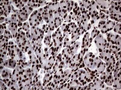 Immunohistochemistry: hnRNP L Antibody (OTI2E4) [NBP2-45990]