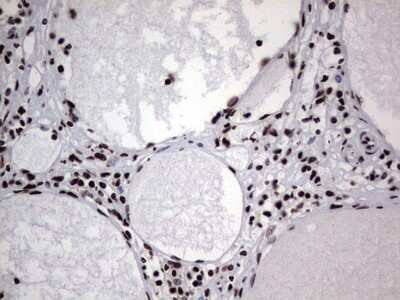 Immunohistochemistry: hnRNP L Antibody (OTI2E4) [NBP2-45990]