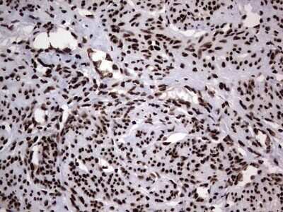 Immunohistochemistry: hnRNP L Antibody (OTI2E4) [NBP2-45990]