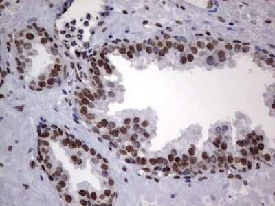 Immunohistochemistry: hnRNP L Antibody (OTI2E4) [NBP2-45990]
