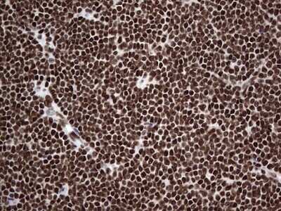 Immunohistochemistry: hnRNP L Antibody (OTI2E4) [NBP2-45990]