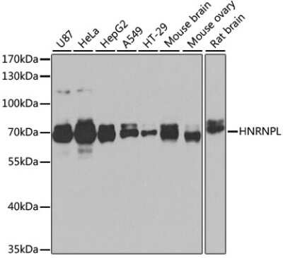 Western Blot: hnRNP L AntibodyBSA Free [NBP3-03640]