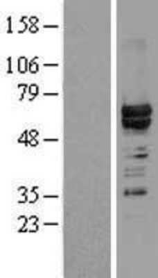 Western Blot: hnRNP L Overexpression Lysate [NBL1-11648]