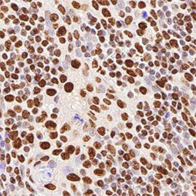 Immunohistochemistry-Paraffin: hnRNP M Antibody (2A6) [NB200-315]