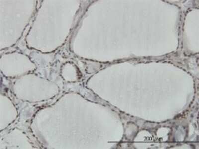 Immunohistochemistry-Paraffin: hnRNP M Antibody (3F7) [H00004670-M03]