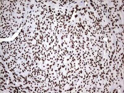 Immunohistochemistry: hnRNP M Antibody (OTI4C9) [NBP2-45991]