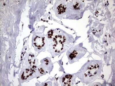 Immunohistochemistry: hnRNP M Antibody (OTI4C9) [NBP2-45991]