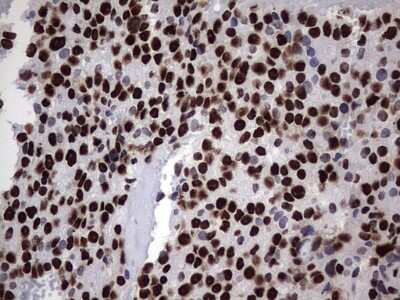 Immunohistochemistry: hnRNP M Antibody (OTI4C9) [NBP2-45991]