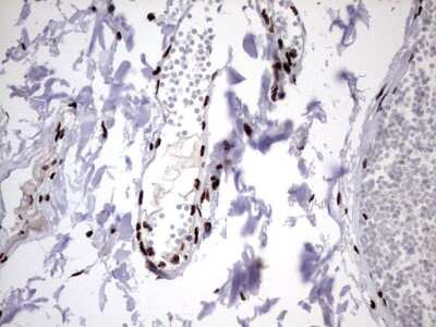 Immunohistochemistry: hnRNP M Antibody (OTI4C9) [NBP2-45991]