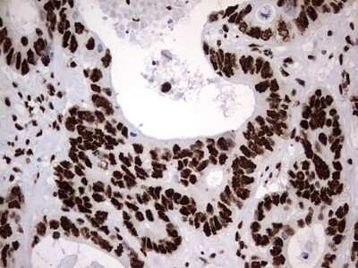 Immunohistochemistry: hnRNP M Antibody (OTI4C9) [NBP2-45991]
