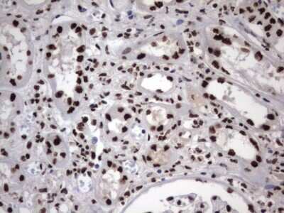Immunohistochemistry: hnRNP M Antibody (OTI4C9) [NBP2-45991]