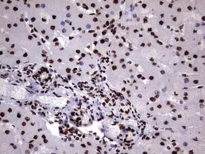 Immunohistochemistry: hnRNP M Antibody (OTI4C9) [NBP2-45991]