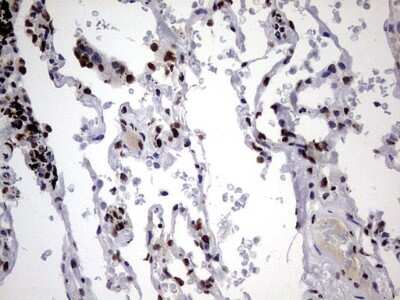 Immunohistochemistry: hnRNP M Antibody (OTI4C9) [NBP2-45991]