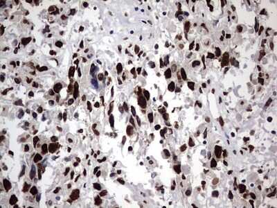 Immunohistochemistry: hnRNP M Antibody (OTI4C9) [NBP2-45991]