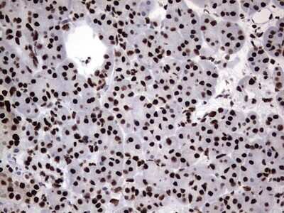 Immunohistochemistry: hnRNP M Antibody (OTI4C9) [NBP2-45991]