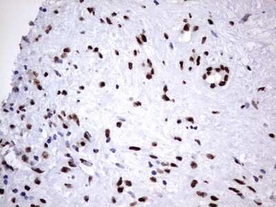Immunohistochemistry: hnRNP M Antibody (OTI4C9) [NBP2-45991]