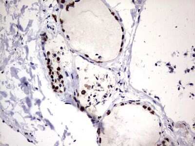 Immunohistochemistry: hnRNP M Antibody (OTI4C9) [NBP2-45991]