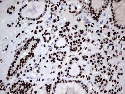 Immunohistochemistry: hnRNP M Antibody (OTI4C9) [NBP2-45991]