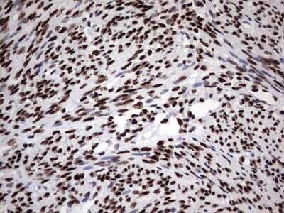 Immunohistochemistry: hnRNP M Antibody (OTI4C9) [NBP2-45991]