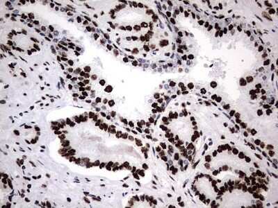 Immunohistochemistry: hnRNP M Antibody (OTI4C9) [NBP2-45991]