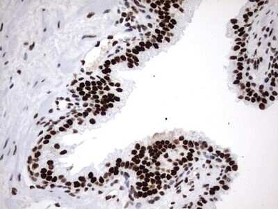 Immunohistochemistry: hnRNP M Antibody (OTI4C9) [NBP2-45991]