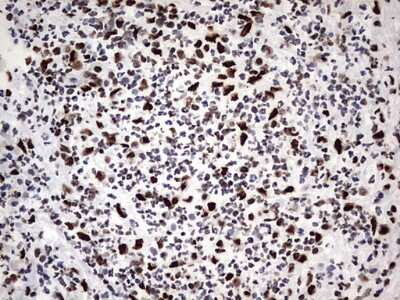 Immunohistochemistry: hnRNP M Antibody (OTI4C9) [NBP2-45991]