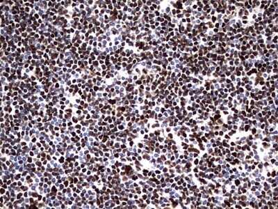 Immunohistochemistry: hnRNP M Antibody (OTI4C9) [NBP2-45991]