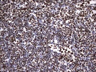 Immunohistochemistry: hnRNP M Antibody (OTI4C9) [NBP2-45991]