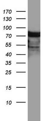 Western Blot: hnRNP M Antibody (OTI4C9) [NBP2-45991]